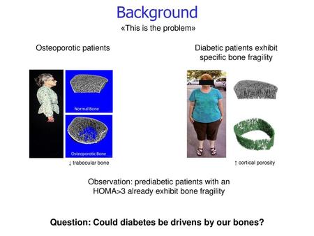 Question: Could diabetes be drivens by our bones?