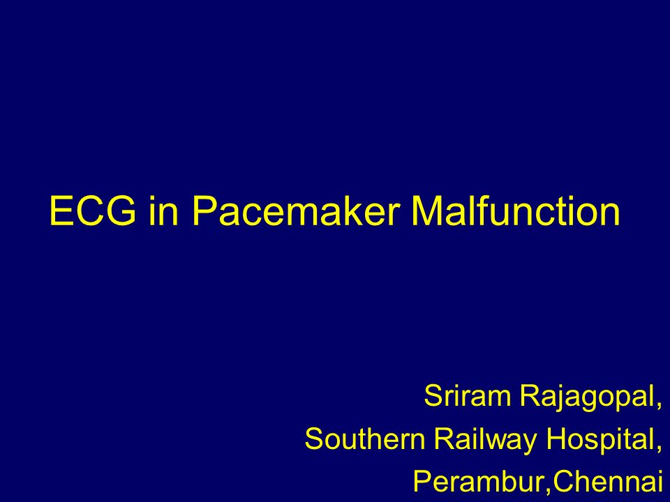 Ecg In Pacemaker Malfunction Ppt Video Online Download