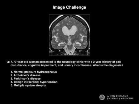 Image Challenge Q: A 70-year-old woman presented to the neurology clinic with a 2-year history of gait disturbance, cognitive impairment, and urinary incontinence.
