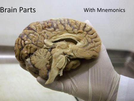 Brain Parts With Mnemonics.