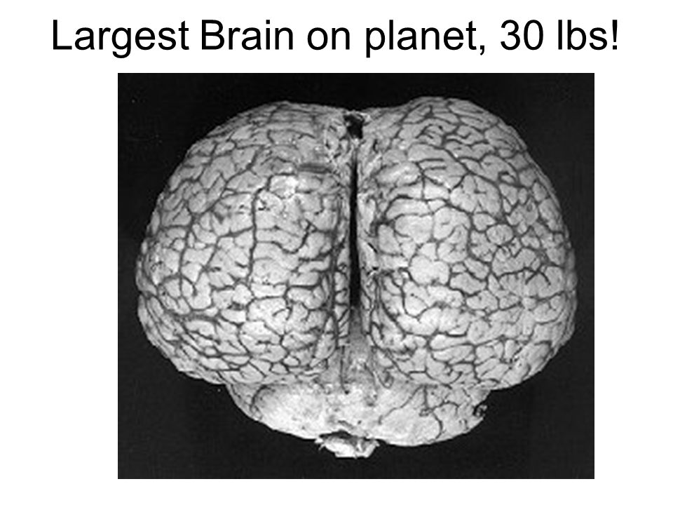 Largest Brain on planet, 30 lbs! - ppt video online download