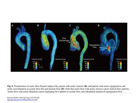 Fig. 9. Visualization of aortic flow