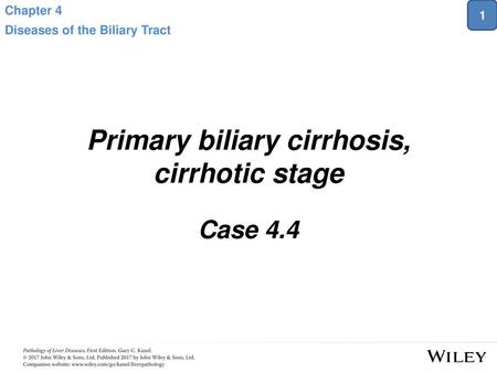 Primary biliary cirrhosis, cirrhotic stage