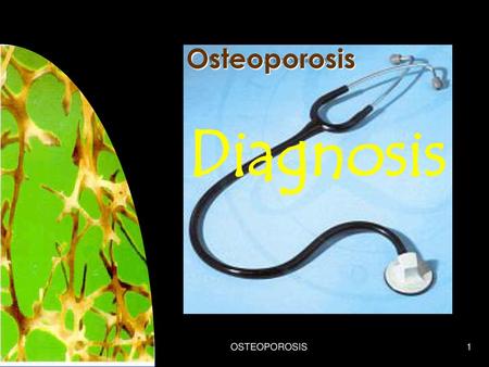 Osteoporosis Diagnosis 9/21/2018 OSTEOPOROSIS.