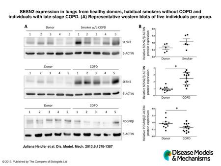 SESN2 expression in lungs from healthy donors, habitual smokers without COPD and individuals with late-stage COPD. (A) Representative western blots of.