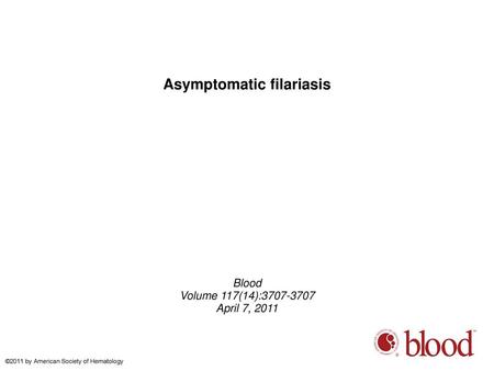 Asymptomatic filariasis