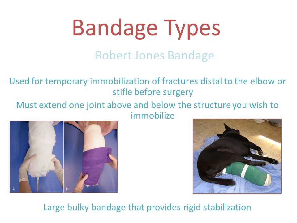 Bandage Types Robert Jones Bandage Used for temporary immobilization of  fractures distal to the elbow or stifle before surgery Must extend one  joint above. - ppt download