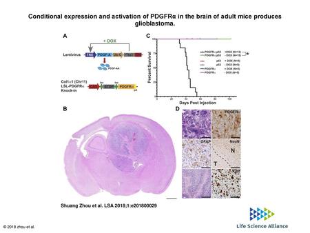Conditional expression and activation of PDGFRα in the brain of adult mice produces glioblastoma. Conditional expression and activation of PDGFRα in the.