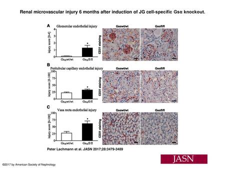 Renal microvascular injury 6 months after induction of JG cell-specific Gsα knockout. Renal microvascular injury 6 months after induction of JG cell-specific.