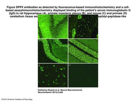 Figure DPPX antibodies as detected by fluorescence-based immunohistochemistry and a cell-based assayImmunohistochemistry displayed binding of the patient's.