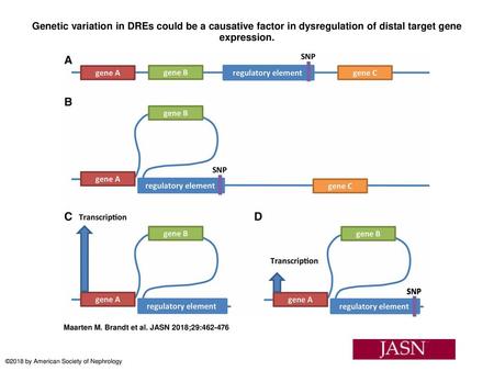 Genetic variation in DREs could be a causative factor in dysregulation of distal target gene expression. Genetic variation in DREs could be a causative.