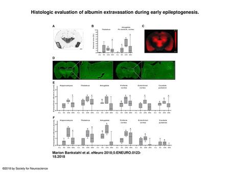 Histologic evaluation of albumin extravasation during early epileptogenesis. Histologic evaluation of albumin extravasation during early epileptogenesis.