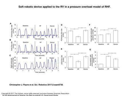 Soft robotic device applied to the RV in a pressure overload model of RHF. Soft robotic device applied to the RV in a pressure overload model of RHF. (A.