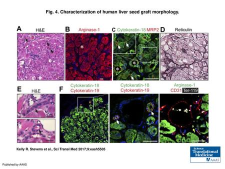 Fig. 4. Characterization of human liver seed graft morphology.