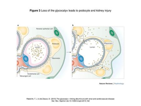 Figure 3 Loss of the glycocalyx leads to podocyte and kidney injury
