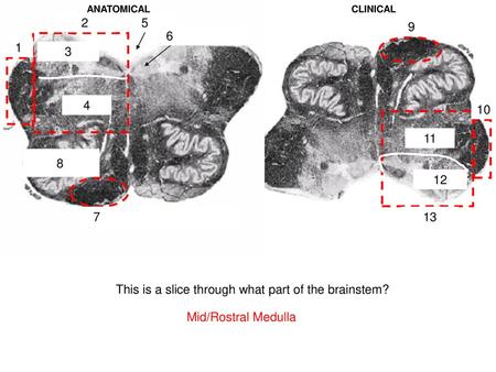 This is a slice through what part of the brainstem?