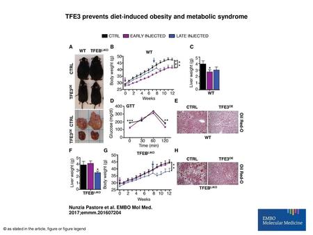 TFE3 prevents diet‐induced obesity and metabolic syndrome