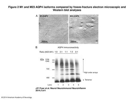 Figure 2 M1 and M23 AQP4 isoforms compared by freeze-fracture electron microscopic and Western blot analyses M1 and M23 AQP4 isoforms compared by freeze-fracture.