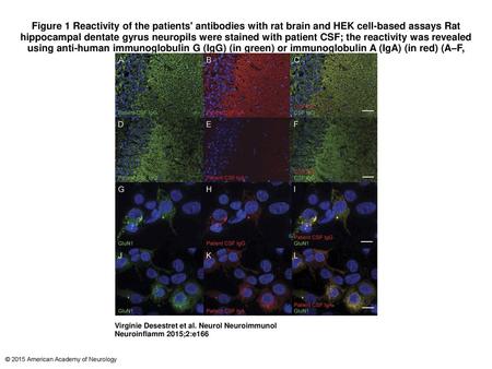 Figure 1 Reactivity of the patients' antibodies with rat brain and HEK cell-based assays Rat hippocampal dentate gyrus neuropils were stained with patient.