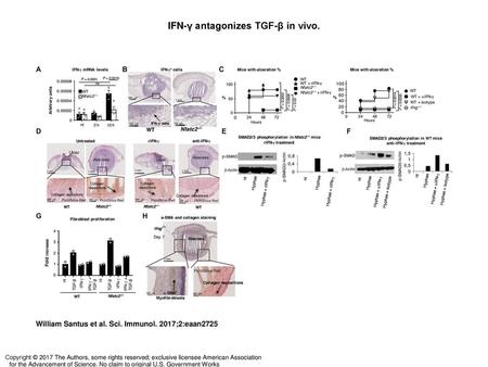 IFN-γ antagonizes TGF-β in vivo.