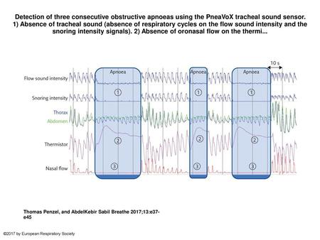 Detection of three consecutive obstructive apnoeas using the PneaVoX tracheal sound sensor. 1) Absence of tracheal sound (absence of respiratory cycles.
