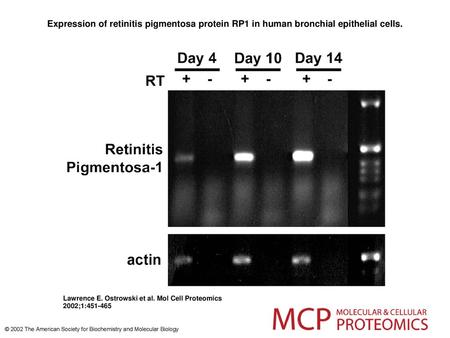 Expression of retinitis pigmentosa protein RP1 in human bronchial epithelial cells. Expression of retinitis pigmentosa protein RP1 in human bronchial epithelial.