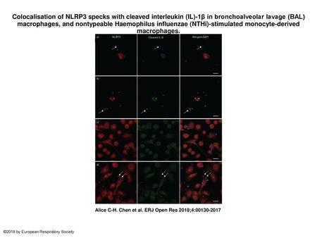 Colocalisation of NLRP3 specks with cleaved interleukin (IL)-1β in bronchoalveolar lavage (BAL) macrophages, and nontypeable Haemophilus influenzae (NTHi)-stimulated.