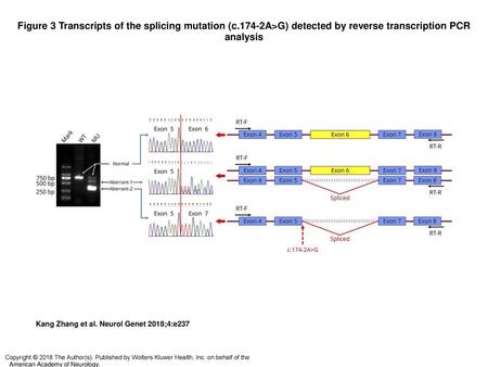 Figure 3 Transcripts of the splicing mutation (c