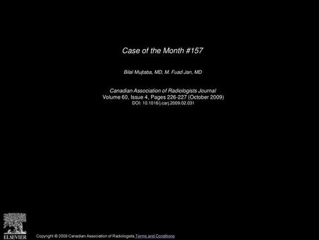 Case of the Month #157 Canadian Association of Radiologists Journal