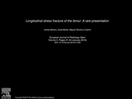 Longitudinal stress fracture of the femur: A rare presentation