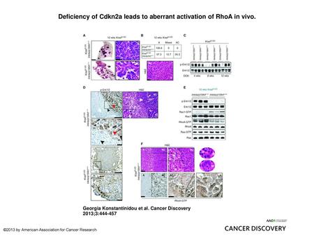 Deficiency of Cdkn2a leads to aberrant activation of RhoA in vivo.