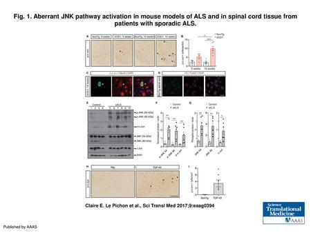 Fig. 1. Aberrant JNK pathway activation in mouse models of ALS and in spinal cord tissue from patients with sporadic ALS. Aberrant JNK pathway activation.
