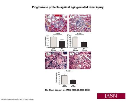 Pioglitazone protects against aging-related renal injury.
