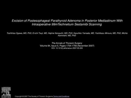 Excision of Postesophageal Parathyroid Adenoma in Posterior Mediastinum With Intraoperative 99mTechnetium Sestamibi Scanning  Toshihisa Ogawa, MD, PhD,