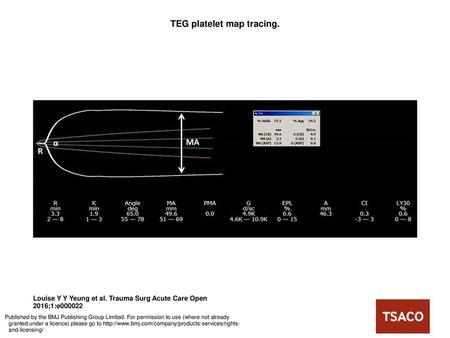TEG platelet map tracing.