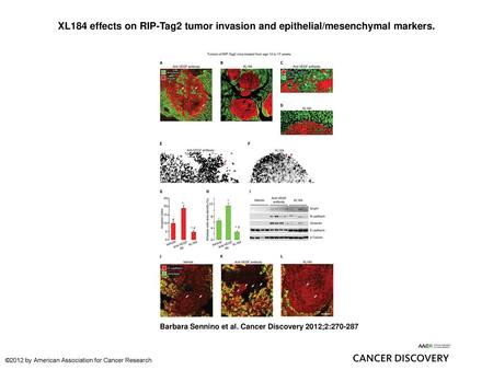 XL184 effects on RIP-Tag2 tumor invasion and epithelial/mesenchymal markers. XL184 effects on RIP-Tag2 tumor invasion and epithelial/mesenchymal markers.
