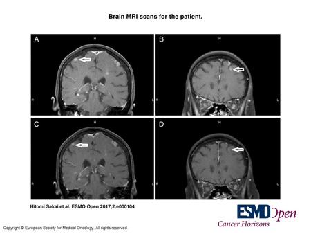 Brain MRI scans for the patient.