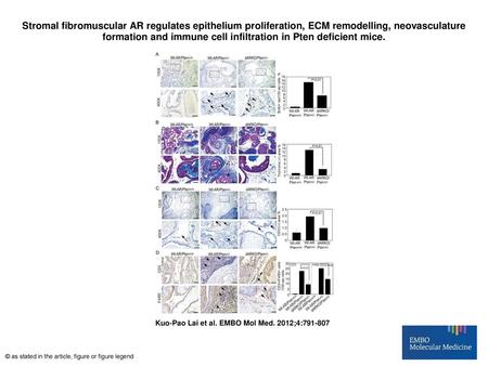 Stromal fibromuscular AR regulates epithelium proliferation, ECM remodelling, neovasculature formation and immune cell infiltration in Pten deficient mice.