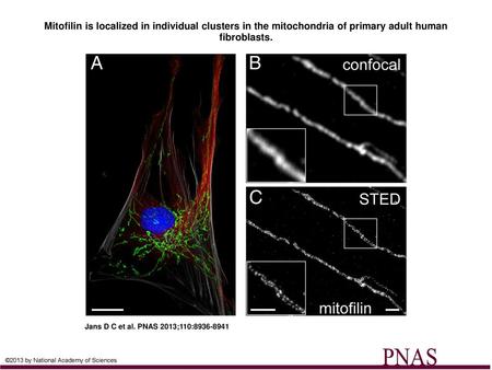 Mitofilin is localized in individual clusters in the mitochondria of primary adult human fibroblasts. Mitofilin is localized in individual clusters in.