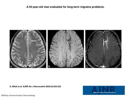 A 25-year-old man evaluated for long-term migraine problems.
