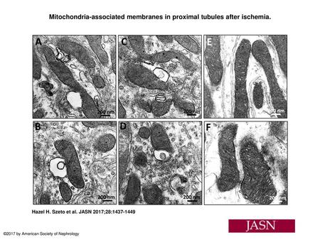 Mitochondria-associated membranes in proximal tubules after ischemia.