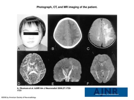 Photograph, CT, and MR imaging of the patient.