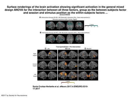 Surface renderings of the brain activation showing significant activation in the general mixed design ANOVA for the interaction between all three factors,