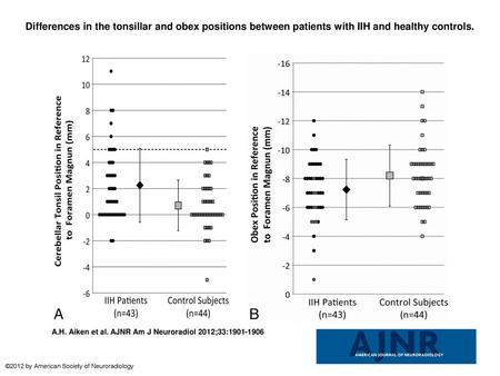 Differences in the tonsillar and obex positions between patients with IIH and healthy controls. Differences in the tonsillar and obex positions between.