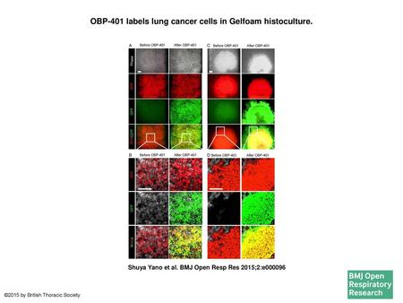 OBP-401 labels lung cancer cells in Gelfoam histoculture.