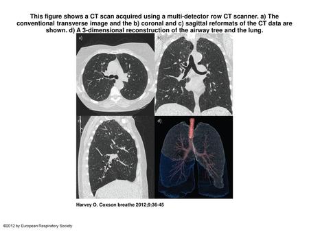 This figure shows a CT scan acquired using a multi-detector row CT scanner. a) The conventional transverse image and the b) coronal and c) sagittal reformats.
