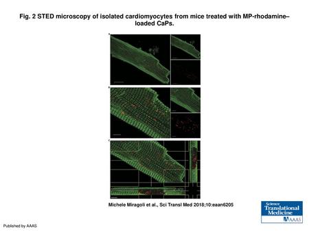 Fig. 2 STED microscopy of isolated cardiomyocytes from mice treated with MP-rhodamine–loaded CaPs. STED microscopy of isolated cardiomyocytes from mice.