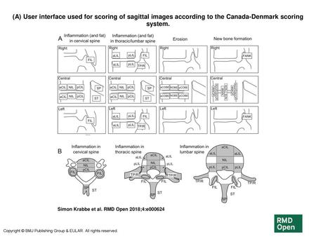 (A) User interface used for scoring of sagittal images according to the Canada-Denmark scoring system. (A) User interface used for scoring of sagittal.