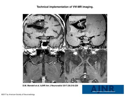 Technical implementation of VW-MR imaging.