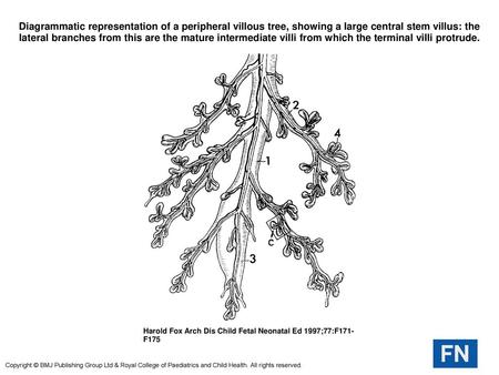 Diagrammatic representation of a peripheral villous tree, showing a large central stem villus: the lateral branches from this are the mature intermediate.